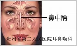 鼻中隔偏曲的病因有哪些