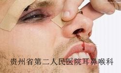 ±Ç×Ó³öѪʱÔõÑù¼±¾È