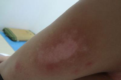 �人ҽԺ�ΰ׻�������