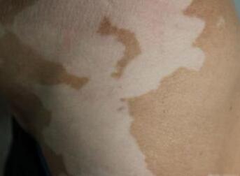 �人�ΰ����ĸ�ҽԺ�Ϻ�