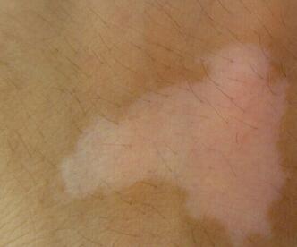 �人������õ�ҽԺ