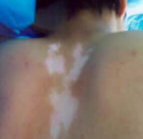 ���ư���ʹ��ҩ��ʱҪע����Щ