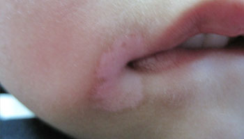 �人���˰���Ӧ����α���