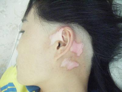 Ů�԰����ճ�����Ҫ��ô����Ч