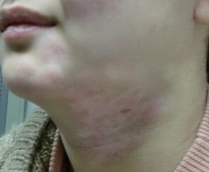 �人�������ҽԺ���ⳤ�˰���Ҫ��ô���ƺ�