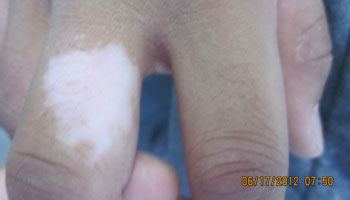 �人�װ�ר��ҽԺ�ļҽϺã����粡�ĳ��ڱ�������Щ