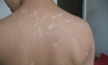 �人���װ߲��Ϻõ�ҽԺ����Щ�װ߳�ʶ����Ӧ���˽��