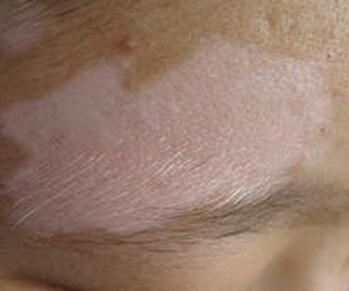 �人���ưװ߲��ĸ�ҽԺ�ã������Ԥ���ͻ�������Щ