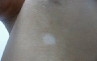 �人�������ҽԺ������ĳ����ٴ�����